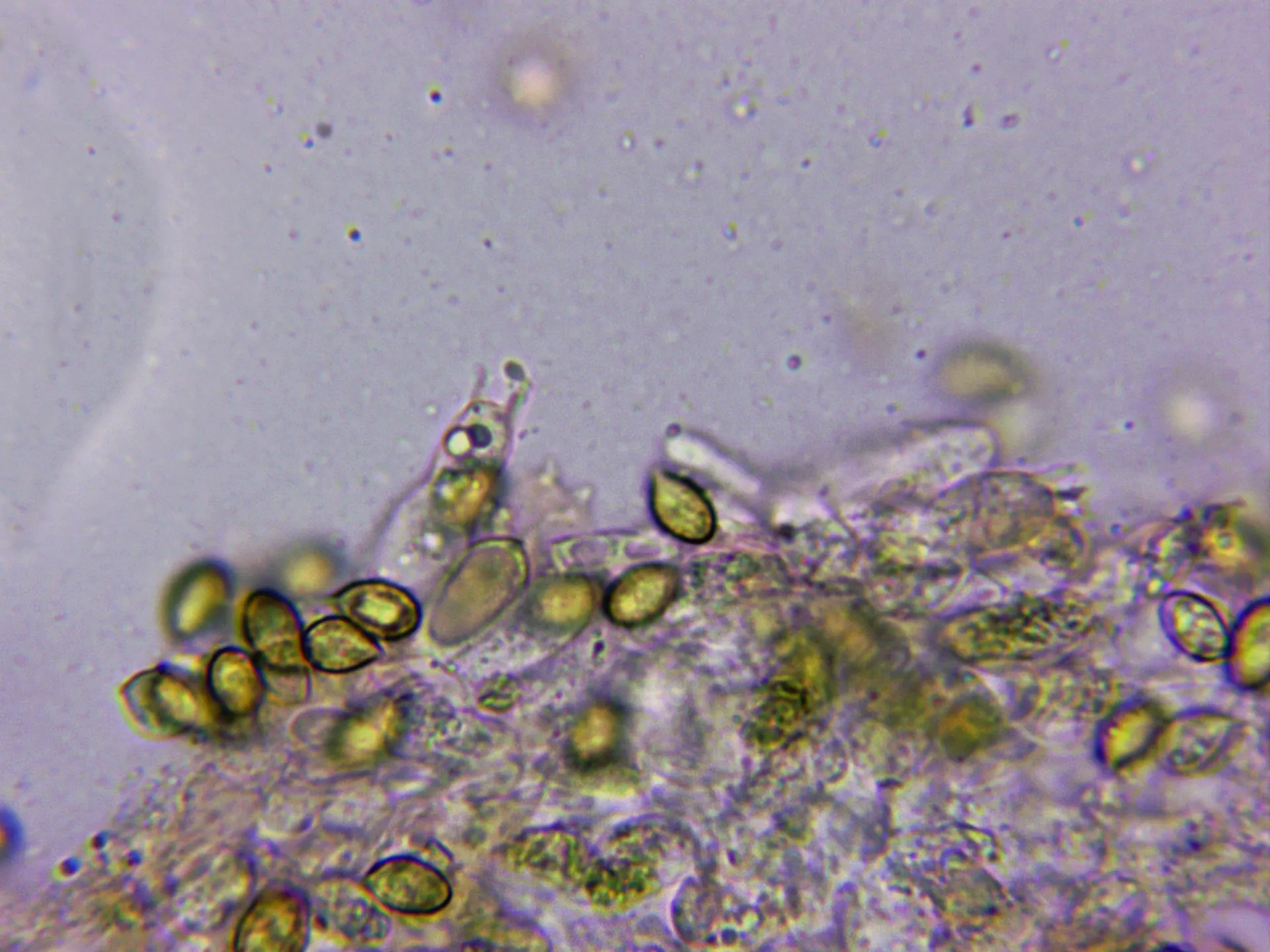 10 - Basidio tetrasporico arista